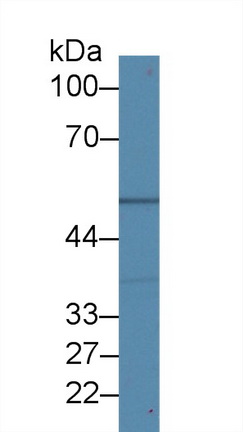 Polyclonal Antibody to Tubulin Beta (TUBb)