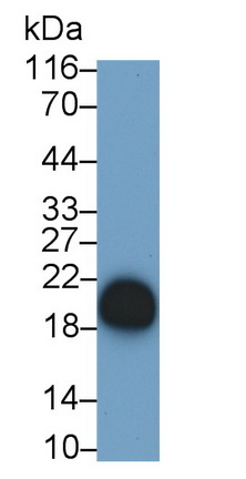 Polyclonal Antibody to Cluster Of Differentiation 3d (CD3d)