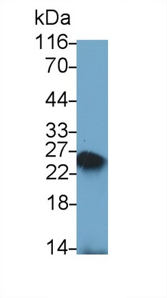 Polyclonal Antibody to Cluster Of Differentiation 3d (CD3d)