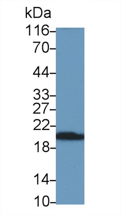 Polyclonal Antibody to Cluster Of Differentiation 3d (CD3d)