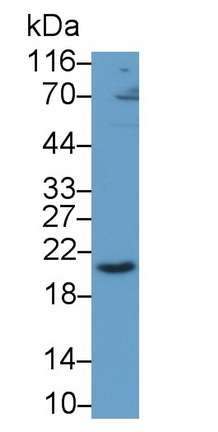 Polyclonal Antibody to Cluster Of Differentiation 3d (CD3d)