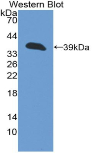 Polyclonal Antibody to Cytokeratin 13 (CK13)