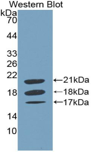 Polyclonal Antibody to Coagulation Factor VIII (F8)