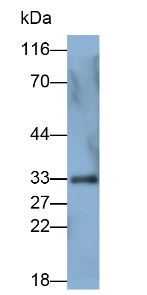 PAB878Hu03.jpg