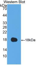 Polyclonal Antibody to Coagulation Factor VIII (F8)