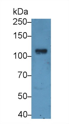 Polyclonal Antibody to Angiotensin I Converting Enzyme 2 (ACE2)