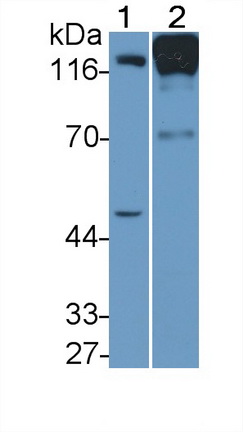 Polyclonal Antibody to Angiotensin I Converting Enzyme 2 (ACE2)