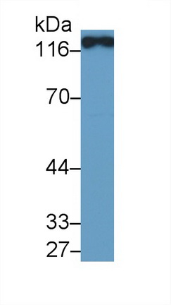 Polyclonal Antibody to Angiotensin I Converting Enzyme 2 (ACE2)