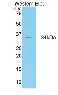 Polyclonal Antibody to Cyclin Dependent Kinase 1 (CDK1)