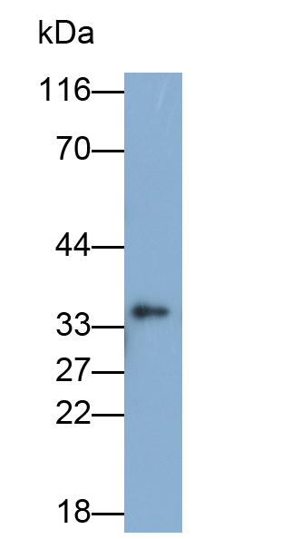 Polyclonal Antibody to Cyclin Dependent Kinase 1 (CDK1)