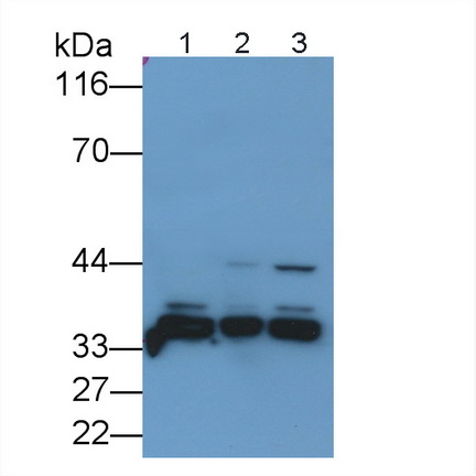 Polyclonal Antibody to Cyclin Dependent Kinase 2 (CDK2)