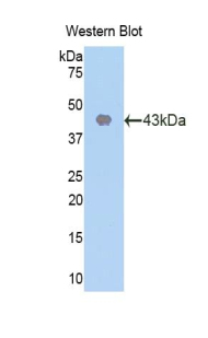 Polyclonal Antibody to Cyclin Dependent Kinase 2 (CDK2)