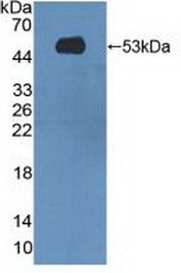 Polyclonal Antibody to Mannose Associated Serine Protease 1 (MASP1)