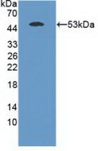 Polyclonal Antibody to Mannose Associated Serine Protease 1 (MASP1)