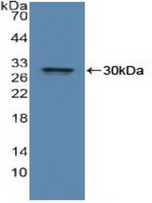 Polyclonal Antibody to Insulin Degrading Enzyme (IDE)