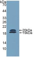 Polyclonal Antibody to Ficolin 2 (FCN2)