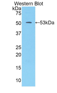 Polyclonal Antibody to Kallikrein 7 (KLK7)