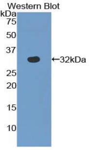 Polyclonal Antibody to S Antigen (SAG)