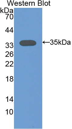 Polyclonal Antibody to Protein Kinase C Alpha (PKCa)