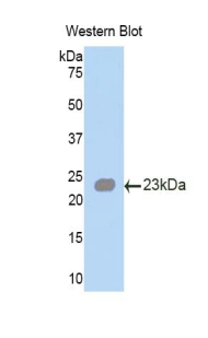 Polyclonal Antibody to Angiopoietin Like Protein 2 (ANGPTL2)