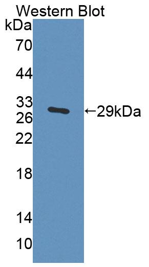 Polyclonal Antibody to Cholinergic Receptor, Nicotinic, Alpha 2 (CHRNa2)