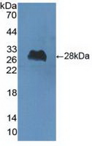 Polyclonal Antibody to Choline Acetyltransferase (ChAT)