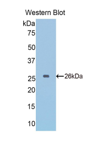 Polyclonal Antibody to Glyceraldehyde-3-Phosphate Dehydrogenase (GAPDH)