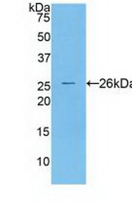 Polyclonal Antibody to Cathepsin S (CTSS)