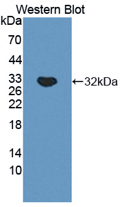 Polyclonal Antibody to Tenascin X (TNX)