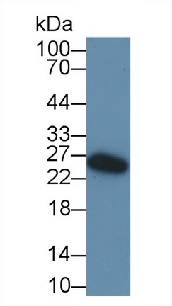 Polyclonal Antibody to Immunoglobulin D (IgD)