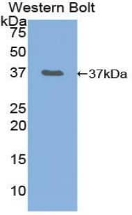 Polyclonal Antibody to Neurofibromin 2 (NF2)