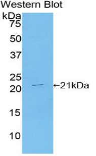 Polyclonal Antibody to Tar DNA Binding Protein 43kDa (TDP43)