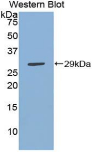 Polyclonal Antibody to Inhibitor Of Nuclear Factor Kappa B Kinase Interacting Protein (IKBIP)