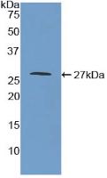 Polyclonal Antibody to Monoamine Oxidase A (MAOA)