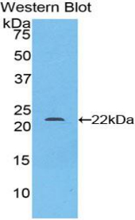 Polyclonal Antibody to Monoamine Oxidase A (MAOA)