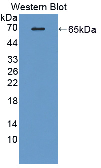 Polyclonal Antibody to Monoamine Oxidase A (MAOA)