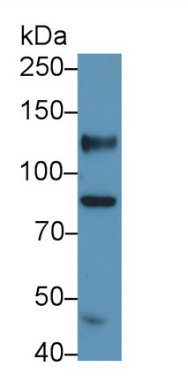 Polyclonal Antibody to Cluster Of Differentiation 34 (CD34)