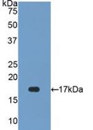 Polyclonal Antibody to Superoxide Dismutase 1 (SOD1)