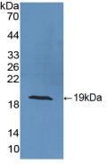 Polyclonal Antibody to Superoxide Dismutase 1 (SOD1)