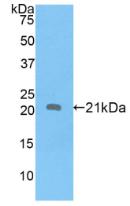 Polyclonal Antibody to Apolipoprotein D (APOD)