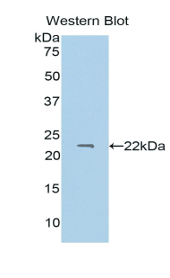 Polyclonal Antibody to Protein S (PROS)