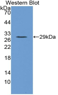 Polyclonal Antibody to Protein S (PROS)