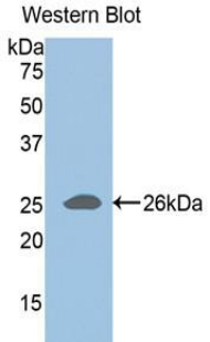 Polyclonal Antibody to A Disintegrin And Metalloproteinase With Thrombospondin 1 (ADAMTS1)