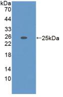 Polyclonal Antibody to A Disintegrin And Metalloproteinase With Thrombospondin 7 (ADAMTS7)