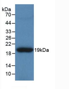 Polyclonal Antibody to Tenascin C (TNC)