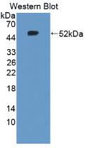 Polyclonal Antibody to Tenascin C (TNC)