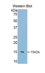 Polyclonal Antibody to Tenascin C (TNC)