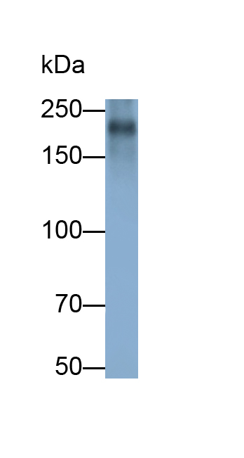 Polyclonal Antibody to Tenascin C (TNC)