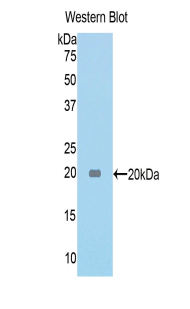 Polyclonal Antibody to Tenascin C (TNC)