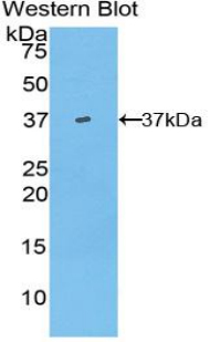 Polyclonal Antibody to Hepcidin (Hepc)